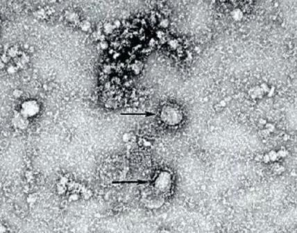 Опубликован первый снимок коронавируса 2019-nCoV под микроскопом